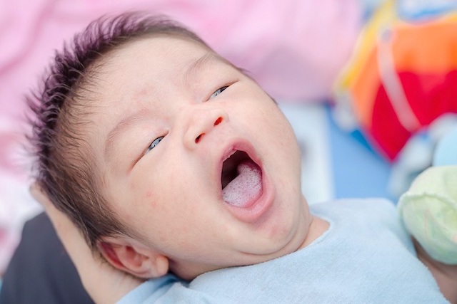 trẻ sơ sinh có nốt trắng trong miệng